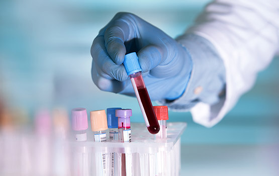 Ensayos Clínicos Fase I-IV